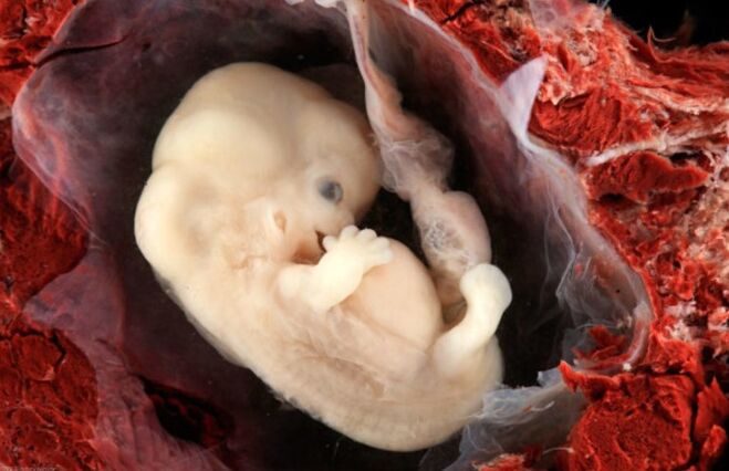Feto -Pathologien sind möglich
